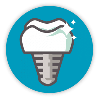 illustration implant dentaire